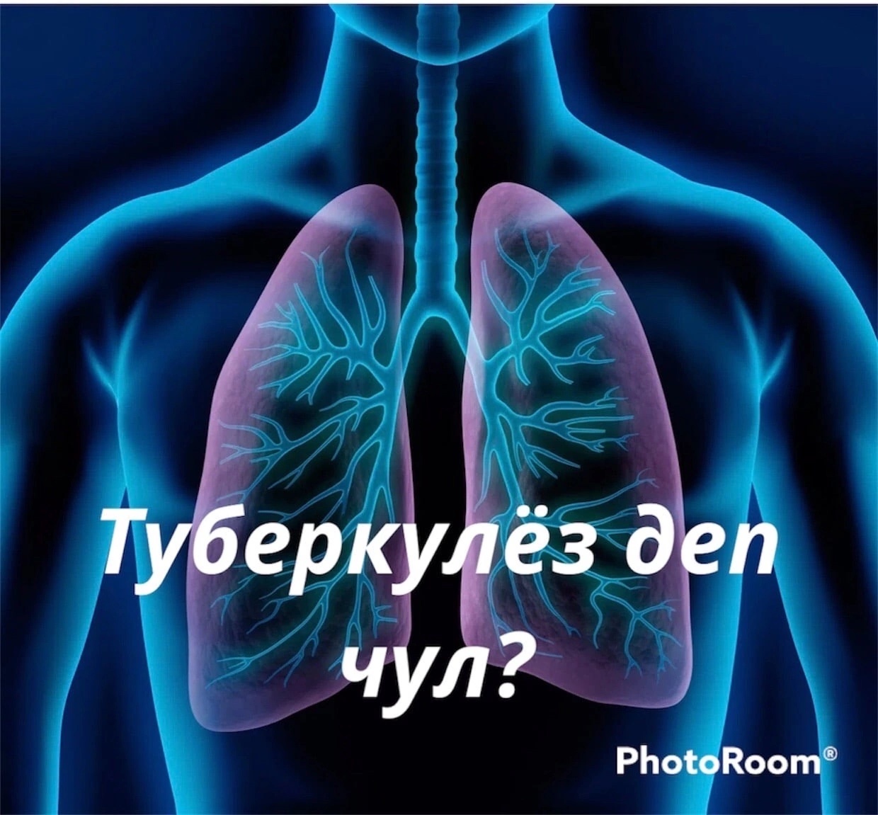 Туберкулез - эгезинден тура, эмнетпес болза, хоочурай бээр халдавырлыг (чыпшынчак) аарыгларның бирээзи. Аарыгның өөскүдүкчүзү каракка көзүлбес бичии микробтар. Олар онзагай быжыг каът-биле шыптынган, өске микробтарга деңнээрге , соокка-даа, изигге-даа бел Туберкулез - эгезинден тура, эмнетпес болза, хоочурай бээр халдавырлыг (чыпшынчак) аарыгларның бирээзи. Аарыгның өөскүдүкчүзү каракка көзүлбес бичии микробтар. Олар онзагай быжыг каът-биле шыптынган, өске микробтарга деңнээрге , соокка-даа, изигге-даа бел